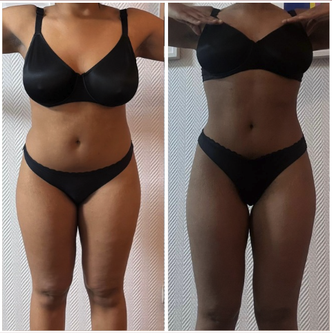 Avant après Camille, perte de 4kg en 1 mois