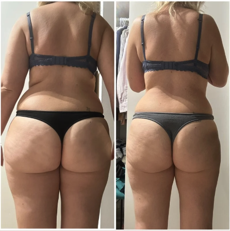 Avant après Marine, perte de 8,15 kg en 4 mois