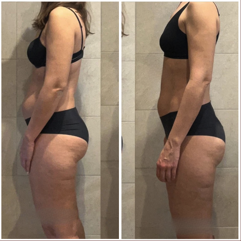 Avant après Sophie, perte de 5 kg en 4 mois